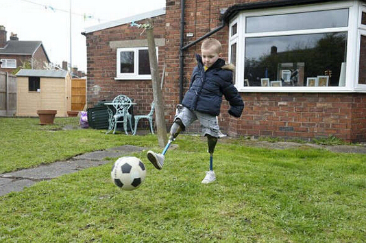 截肢男人励志视频,截肢男孩哭了视频