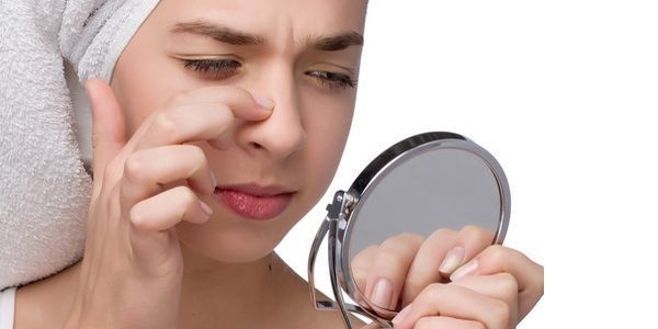 脸上的黑头能去除吗,脸上痘痘黑头怎么去除