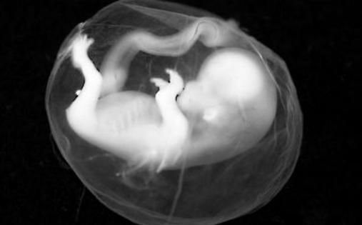 32周胎儿没动怎么回事,32周胎儿有心跳突然几天不动了