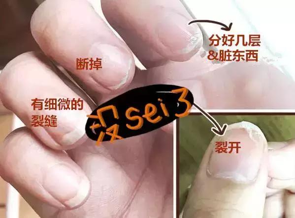 剪指甲的时候为什么会飞出去,为什么剪指甲指甲会乱飞