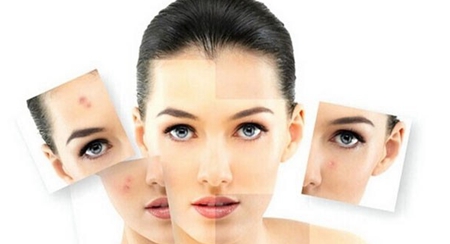 油性皮肤如何去痘痘这些方法你值得一试