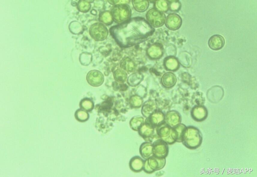 成熟的CTY微囊渗透技术或将扩大修复凝胶的母婴市场份额