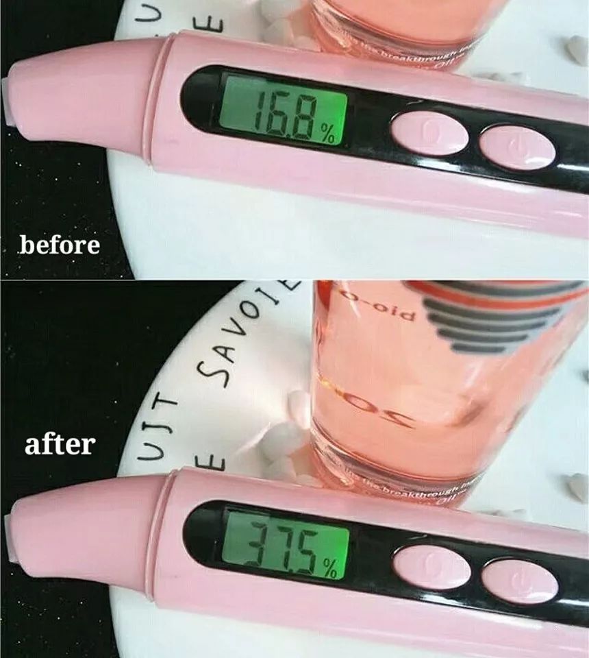 深扒“网红”神油,8周改善妊娠纹和疤痕~