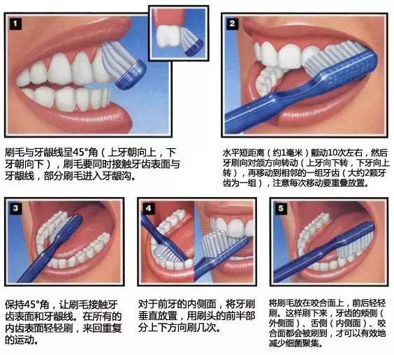 有颗牙齿很臭,拔掉的牙齿很臭
