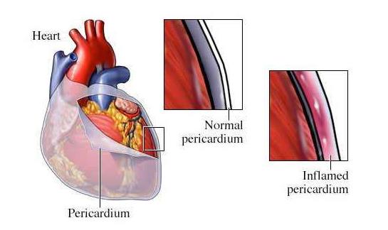 男性冠心病发病率比女性更高,男性发病率