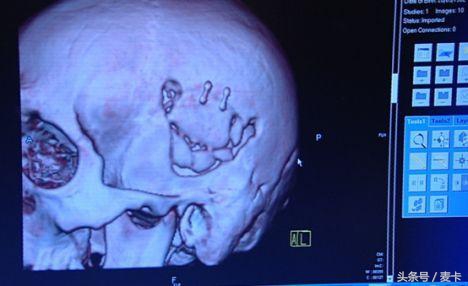 切尔西灭门惨案,切尔西雷丁灭门惨案