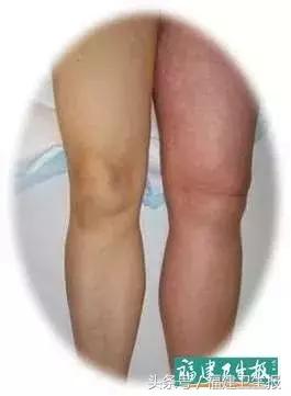 女人吃避孕药是否导致月经不正常,女子服用避孕药调理