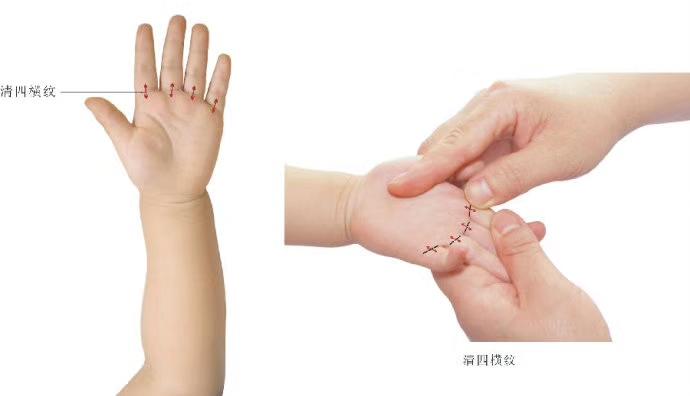 小儿推拿,小儿推拿视频免费教程全集