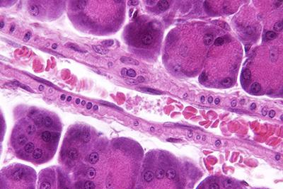 激光血氧治疗仪对脑梗有没有帮助,弱激光对血管的危害
