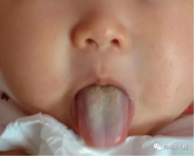 黄帝内经眼袋描述,黄帝内经中讲怎样让眼袋去掉