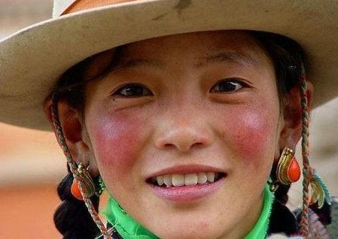 皮肤粘胶带过敏用什么方法不过敏,皮肤红痒过敏好了过几天后过敏