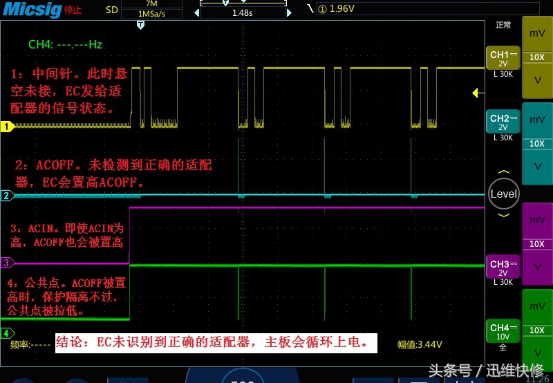 笔记本电源插口中间的针,笔记本电源适配器输出有几根线