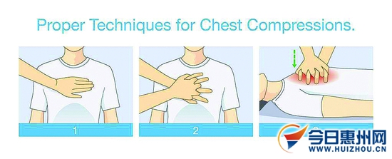 老人心脏骤停及时心肺复苏挽回,老人心脏骤停抢救成功率