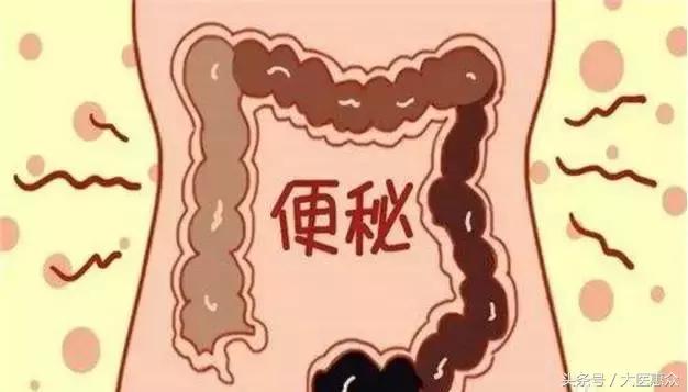 肠道便秘的症状有哪些,肠道老是便秘