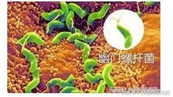 儿童幽门螺杆菌怎么彻底治疗,幽门螺杆菌如何治疗彻底根除