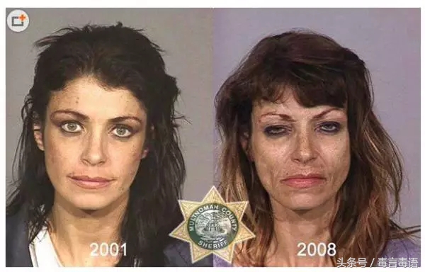 触目惊心吸毒前后真实的变化,吸毒的危害到底有多严重图片