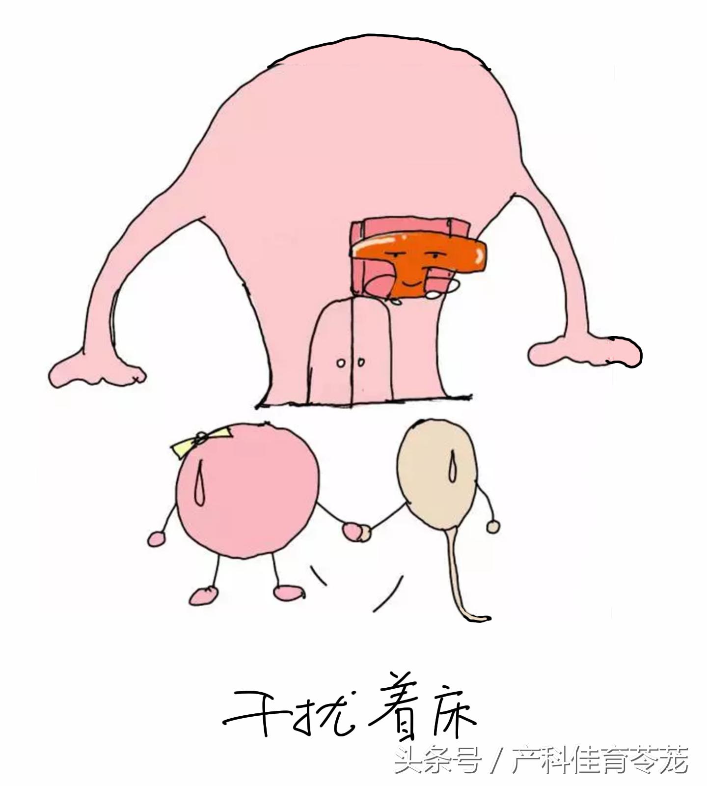 上环15天后还用避孕吗,上环前你应该详细了解这些知识