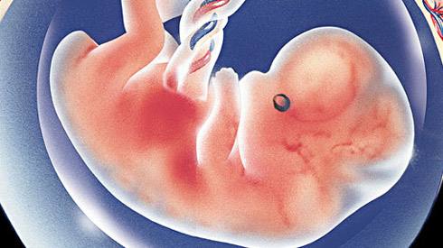 b超显示胎儿脑积水0.4,胎儿左侧脑室宽度9.2毫米是畸形吗