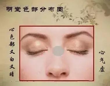 面诊鼻头发黑,中医面诊之鼻