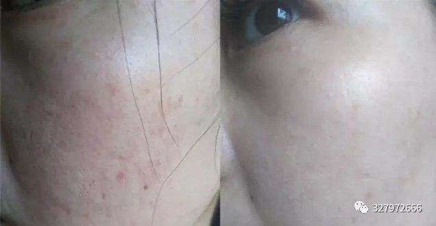 朵嘉浓可以修复肌肤屏障吗,朵嘉浓怎么修护激素脸