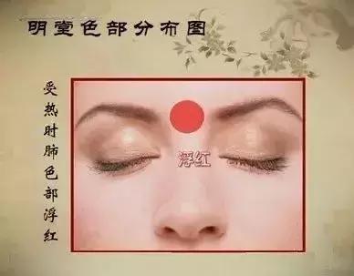 中医望诊鼻子发青,受凉鼻根发青是什么原因