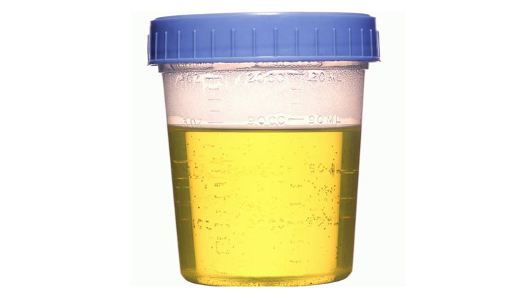 人不喝水能维持多少天,人不喝水极限能活几天