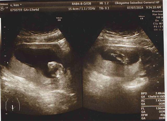 b超医生不愿意说的秘密,b超室医生擅长什么