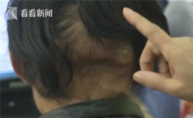 29岁小伙抗癌四年临终信视频,四川23岁小伙抗癌6年自愿捐献遗体