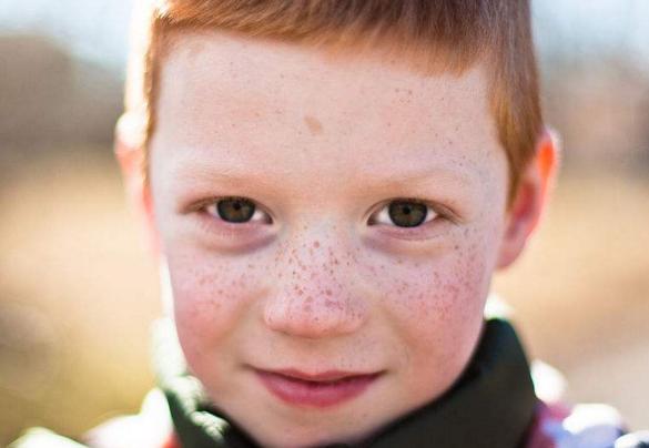 绉嬭幉闈㈤儴鎶よ偆,绉嬭幉缇庡