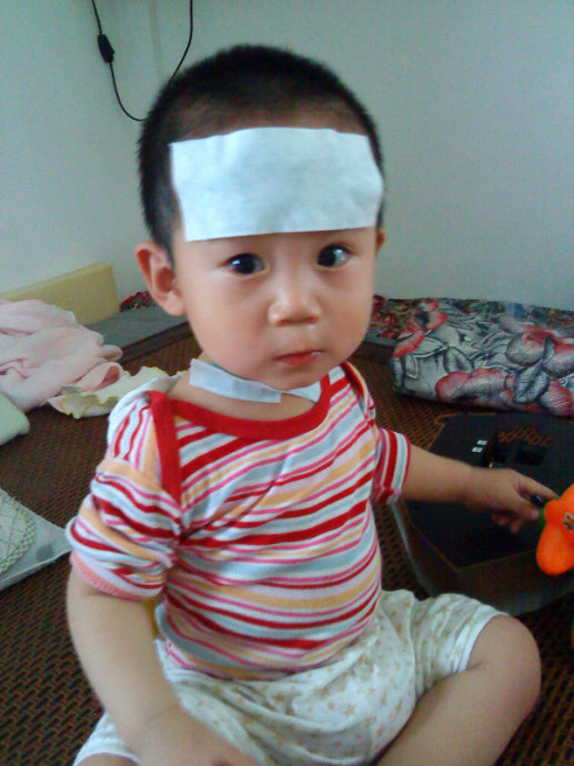 幼儿急疹全攻略,幼儿急疹的100个常识