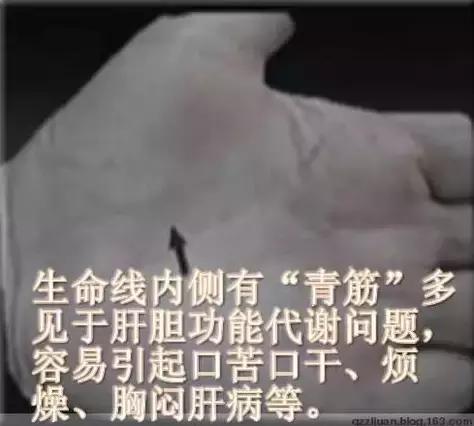 青筋的手诊方法,全身青筋诊病全集