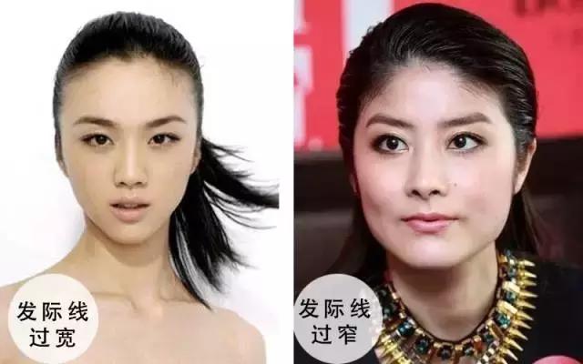 90后脱发的原因和治疗方法,中年脱发真的是一大考验