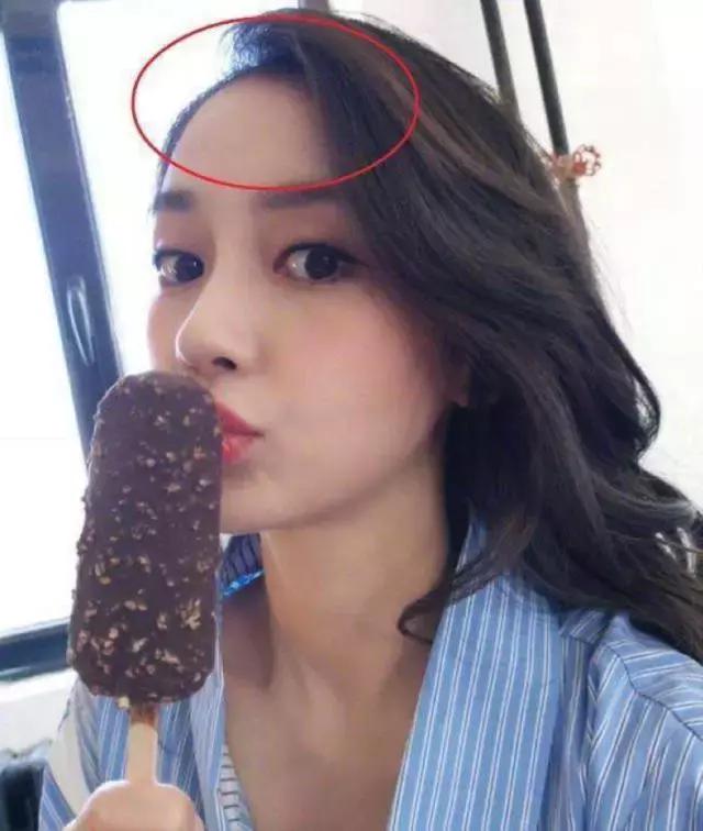 90后脱发的原因和治疗方法,中年脱发真的是一大考验