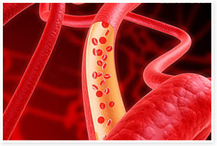 治疗真性红细胞增多症的偏方,真红细胞增多症可以用cart治疗吗
