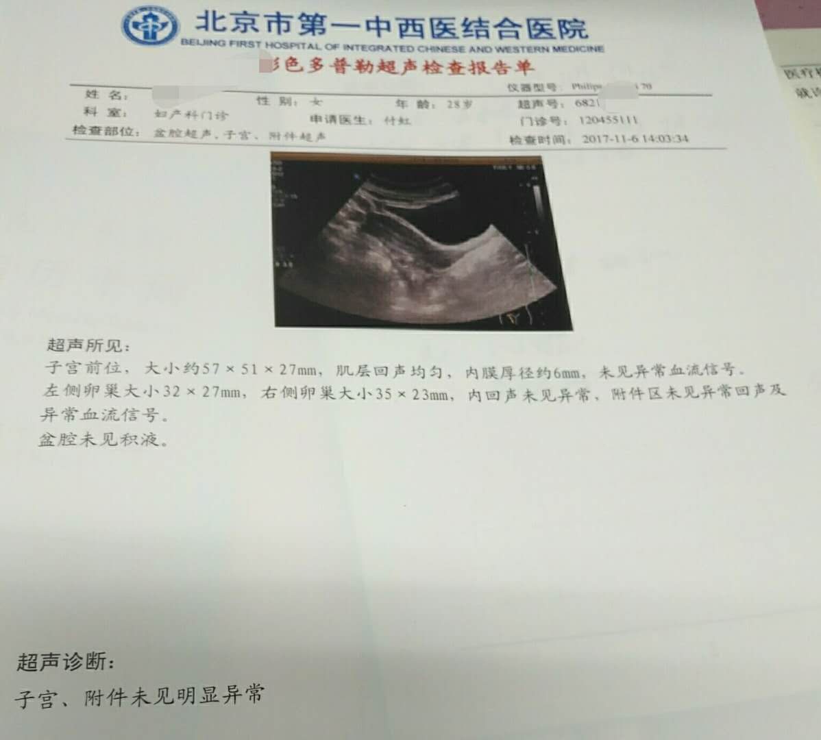 产后不哺乳3个月还没有来月经,产后不喂奶是不是就没奶了