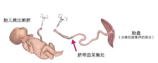 癌症有真性假性吗,癌症患者可以存脐带血吗