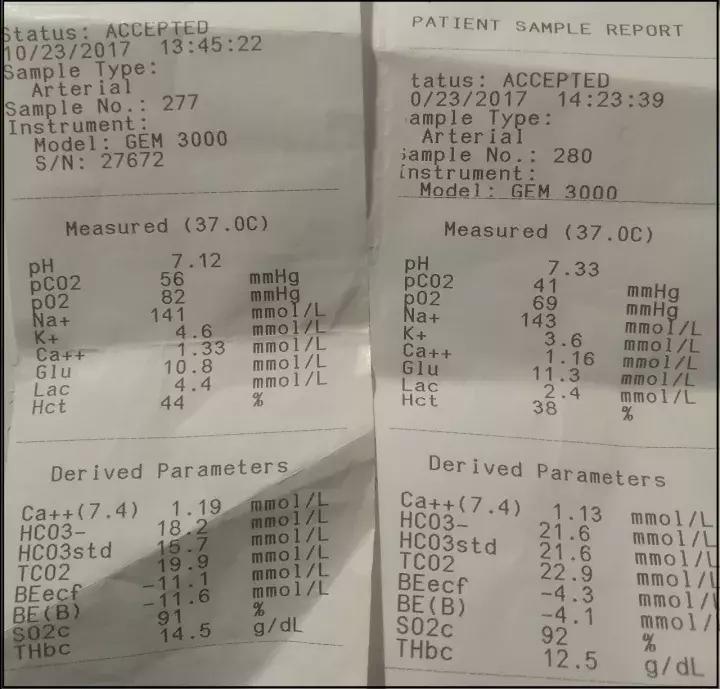 术后寒战用什么药,ptcd引流术后寒战