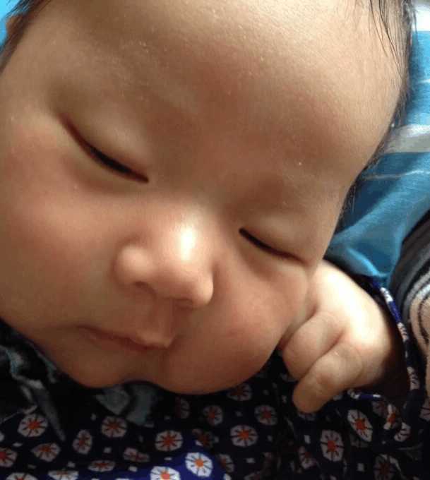 3个月的小宝宝容易长湿疹,刚出生宝宝一脸湿疹