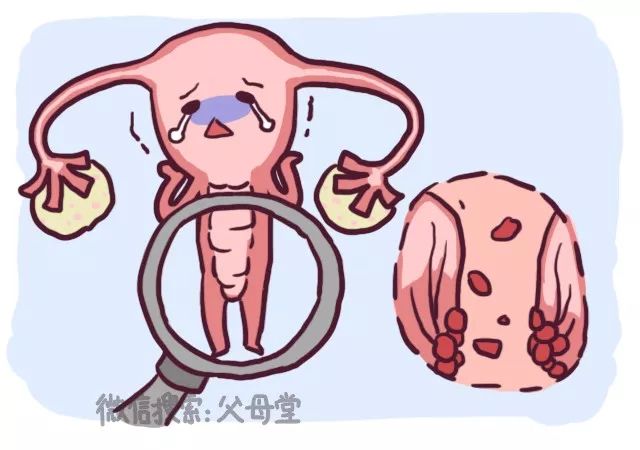 宫颈癌疫苗接种禁忌症和注意事项,9到14岁宫颈癌疫苗有必要打吗