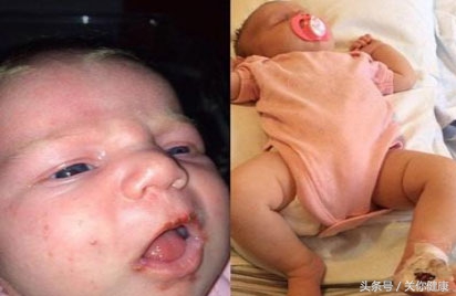 绮夊瀚╃殑濠村効,绮夊鍙埍濠村効