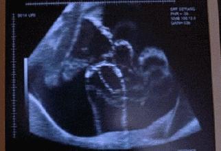 胎动变少,意味着什么?