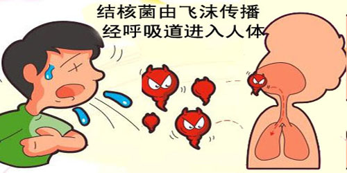 肺结核做了介入手术以后的并发症,肺结核引起相关临床症状