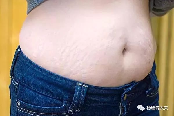 女人生完孩子最怕三处变化，专家告诉您该怎么补救？