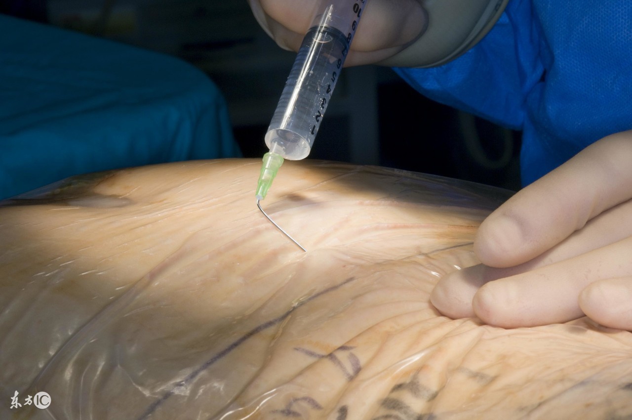 阿司匹林副作用人人都会有吗,阿司匹林不适合哪些人群