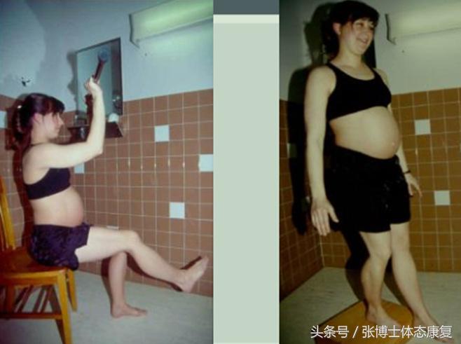 孕期耻骨疼多锻炼可以缓解吗,孕期耻骨疼怎么通过锻炼缓解