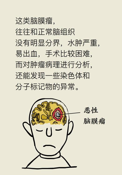 脑袋里长瘤子一定要切除吗,脑袋里长瘤能治好吗