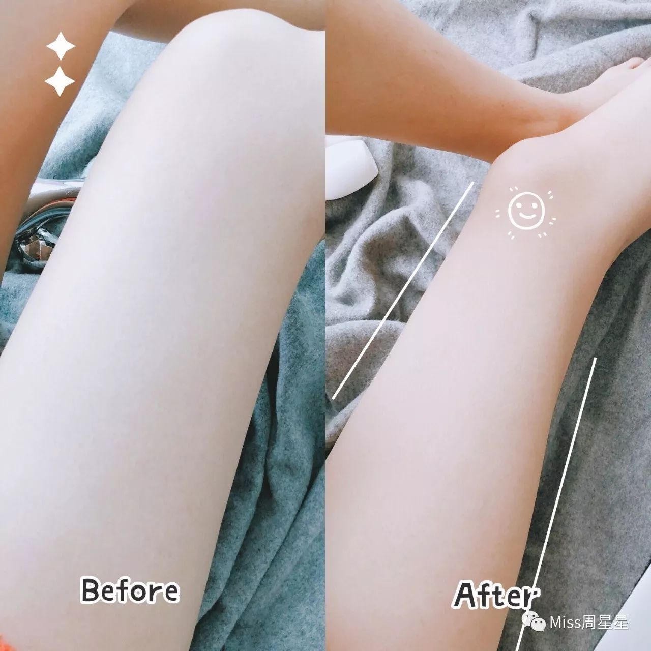 wellbox美容仪使用期限,万能美容仪wellbox