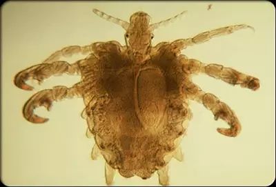 怎样判定身上痒是疥疮,专家治疗皮肤瘙痒症视频