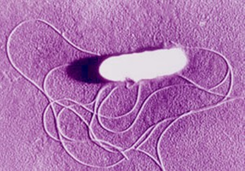 孕妇生产时遇到的凶险并发症,孕妇生产死亡的概率