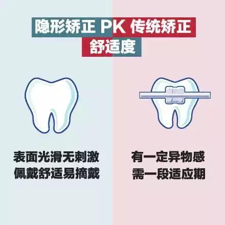 美丽刻隐形矫正怎么样,隐形矫正牙齿视频教程